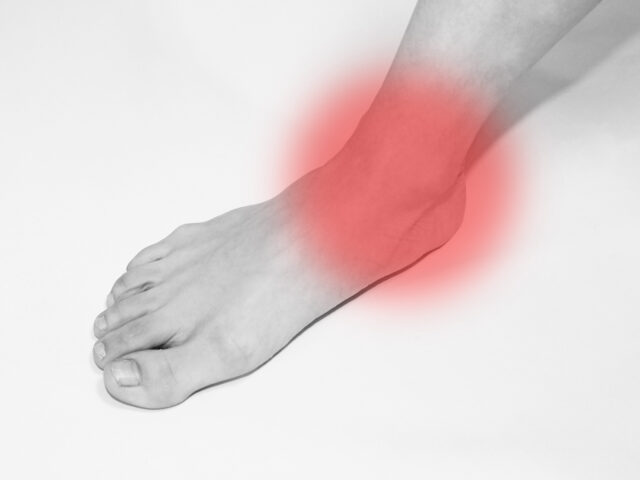 捻挫後に「違う場所」が痛い？足の内側の骨が出っ張る有痛性外脛骨