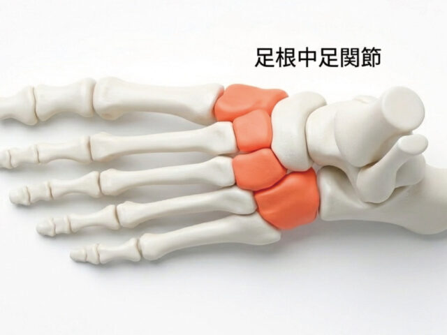 「骨に異常なし」でも痛い足の甲。リスフラン関節症の原因とは